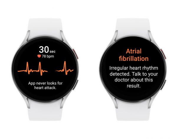 FDA Clears Samsung’s Irregular Heart Rhythm Notification