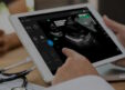 FDA Grants Clearance for UltraSight's AI Cardiac Ultrasound